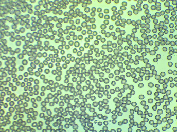 blood smear kucing